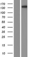 PKP4 / Plakophilin 4 Protein - Western validation with an anti-DDK antibody * L: Control HEK293 lysate R: Over-expression lysate