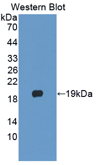 PLA2G10 Antibody - Western blot of PLA2G10 antibody.