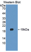 PLA2G10 Antibody - Western blot of PLA2G10 antibody.