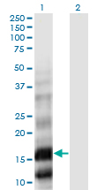 PLA2G10 Antibody - Western Blot analysis of PLA2G10 expression in transfected 293T cell line by PLA2G10 monoclonal antibody (M01), clone 5G11.Lane 1: PLA2G10 transfected lysate (Predicted MW: 18.2 KDa).Lane 2: Non-transfected lysate.