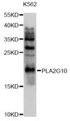 PLA2G10 Antibody - Western blot analysis of extracts of K562 cells, using PLA2G10 antibody at 1:1000 dilution. The secondary antibody used was an HRP Goat Anti-Rabbit IgG (H+L) at 1:10000 dilution. Lysates were loaded 25ug per lane and 3% nonfat dry milk in TBST was used for blocking. An ECL Kit was used for detection and the exposure time was 90s.