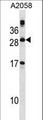 PLA2G12A Antibody - PLA2G12A Antibody western blot of A2058 cell line lysates (35 ug/lane). The PLA2G12A antibody detected the PLA2G12A protein (arrow).