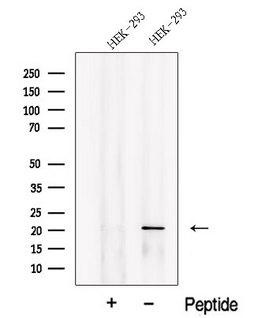 PLA2G12A Antibody - Western blot analysis of extracts of HEK293 cells using PLA2G12A antibody. The lane on the left was treated with blocking peptide.