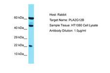PLA2G12B Antibody -  This image was taken for the unconjugated form of this product. Other forms have not been tested.