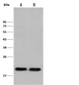 PLA2G12B Antibody - Anti-Pla2g12b rabbit polyclonal antibody at 1:500 dilution. Lane A: Mouse liver tissue lysate. Lane B: HT1080 Whole Cell Lysate. Lysates/proteins at 30 ug per laneSecondaryGoat Anti-Rabbit IgG (H+L)/HRP at 1/10000 dilution. Developed using the ECL technique. Performed under reducing conditions. Predicted band size: 22 kDa. Observed band size: 22 kDa.