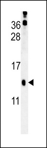 PLA2G16 / HRASLS3 Antibody - HRASLS3 Antibody western blot of mouse kidney tissue lysates (15 ug/lane). The HRASLS3 antibody detected HRASLS3 protein (arrow).