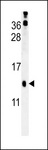 PLA2G16 / HRASLS3 Antibody - HRASLS3 Antibody western blot of mouse kidney tissue lysates (15 ug/lane). The HRASLS3 antibody detected HRASLS3 protein (arrow).