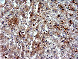 PLA2G16 / HRASLS3 Antibody - IHC of paraffin-embedded Human liver tissue using anti-PLA2G16 mouse monoclonal antibody. (Heat-induced epitope retrieval by 10mM citric buffer, pH6.0, 120°C for 3min).