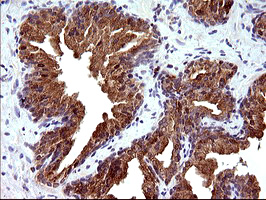 PLA2G16 / HRASLS3 Antibody - IHC of paraffin-embedded Human prostate tissue using anti-PLA2G16 mouse monoclonal antibody. (Heat-induced epitope retrieval by 10mM citric buffer, pH6.0, 120°C for 3min).