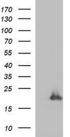 PLA2G16 / HRASLS3 Antibody - HEK293T cells were transfected with the pCMV6-ENTRY control (Left lane) or pCMV6-ENTRY PLA2G16 (Right lane) cDNA for 48 hrs and lysed. Equivalent amounts of cell lysates (5 ug per lane) were separated by SDS-PAGE and immunoblotted with anti-PLA2G16.