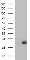 PLA2G16 / HRASLS3 Antibody - HEK293T cells were transfected with the pCMV6-ENTRY control (Left lane) or pCMV6-ENTRY PLA2G16 (Right lane) cDNA for 48 hrs and lysed. Equivalent amounts of cell lysates (5 ug per lane) were separated by SDS-PAGE and immunoblotted with anti-PLA2G16.