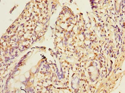 PLA2G16 / HRASLS3 Antibody - Immunohistochemistry of paraffin-embedded human small intestine tissue using antibody at dilution of 1:100.