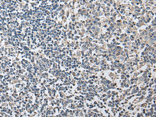 PLA2G16 / HRASLS3 Antibody - Immunohistochemistry of paraffin-embedded Human tonsil tissue  using PLA2G16 Polyclonal Antibody at dilution of 1:40(×200)
