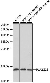PLA2G1B Antibody - Western blot analysis of extracts of various cell lines using PLA2G1B Polyclonal Antibody at dilution of 1:1000.