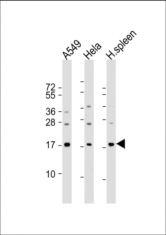 PLA2G2A / SPLA2 Antibody - All lanes: Anti-PLA2G2A Antibody (C-Term) at 1:2000 dilution. Lane 1: A549 whole cell lysate. Lane 2: HeLa whole cell lysate. Lane 3: human spleen lysate Lysates/proteins at 20 ug per lane. Secondary Goat Anti-Rabbit IgG, (H+L), Peroxidase conjugated at 1:10000 dilution. Predicted band size: 16 kDa. Blocking/Dilution buffer: 5% NFDM/TBST.