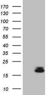 PLA2G2A / SPLA2 Antibody - HEK293T cells were transfected with the pCMV6-ENTRY control. (Left lane) or pCMV6-ENTRY PLA2G2A. (Right lane) cDNA for 48 hrs and lysed. Equivalent amounts of cell lysates. (5 ug per lane) were separated by SDS-PAGE and immunoblotted with anti-PLA2G2A. (1:2000)