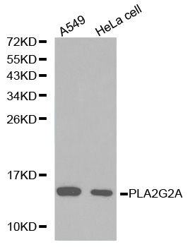 PLA2G2A / SPLA2 Antibody - Western blot analysis of A549 cell and HeLa cell lysate.