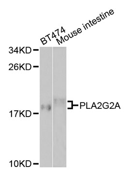 PLA2G2A / SPLA2 Antibody - Western blot analysis of extracts of various cell lines, using PLA2G2A antibody at 1:1000 dilution. The secondary antibody used was an HRP Goat Anti-Rabbit IgG (H+L) at 1:10000 dilution. Lysates were loaded 25ug per lane and 3% nonfat dry milk in TBST was used for blocking.