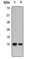 PLA2G2A / SPLA2 Antibody