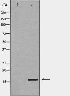PLA2G2A / SPLA2 Antibody - Western blot analysis of A549 cells using PLA2G2A antibody. The lane on the left is treated with the antigen-specific peptide.