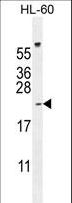 PLA2G2C Antibody - PLA2G2C Antibody western blot of HL-60 cell line lysates (35 ug/lane). The PLA2G2C antibody detected the PLA2G2C protein (arrow).