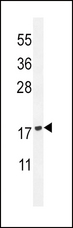 PLA2G2D Antibody - PLA2G2D Antibody western blot of HL-60 cell line lysates (35 ug/lane). The PLA2G2D antibody detected the PLA2G2D protein (arrow).