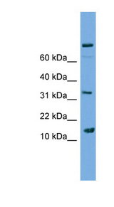 PLA2G2E Antibody - Anti-PLA2G2E antibody western blot of Jurkat lysate.  This image was taken for the unconjugated form of this product. Other forms have not been tested.