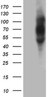 PLA2G3 Antibody - HEK293T cells were transfected with the pCMV6-ENTRY control. (Left lane) or pCMV6-ENTRY PLA2G3. (Right lane) cDNA for 48 hrs and lysed. Equivalent amounts of cell lysates. (5 ug per lane) were separated by SDS-PAGE and immunoblotted with anti-PLA2G3. (1:500)