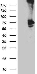 PLA2G3 Antibody - HEK293T cells were transfected with the pCMV6-ENTRY control. (Left lane) or pCMV6-ENTRY PLA2G3. (Right lane) cDNA for 48 hrs and lysed. Equivalent amounts of cell lysates. (5 ug per lane) were separated by SDS-PAGE and immunoblotted with anti-PLA2G3. (1:2000)