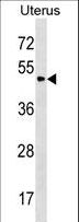 PLA2G3 Antibody - PLA2G3 Antibody western blot of Uterus tissue lysates (35 ug/lane). The PLA2G3 antibody detected the PLA2G3 protein (arrow).