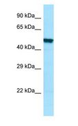 PLA2G3 Antibody - PLA2G3 antibody Western Blot of HT1080.  This image was taken for the unconjugated form of this product. Other forms have not been tested.