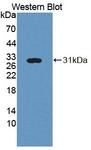 PLA2G3 Antibody - Western Blot; Sample: Recombinant protein.