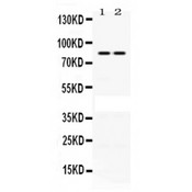 PLA2G4A Antibody - PLA2G4A antibody Western blot. All lanes: Anti PLA2G4A at 0.5 ug/ml. Lane 1: HELA Whole Cell Lysate at 40 ug. Lane 2: NIH3T3 Whole Cell Lysate at 40 ug. Predicted band size: 85 kD. Observed band size: 85 kD.