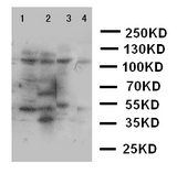 PLA2G4A Antibody - WB of PLA2G4 / PLA2G4A antibody. Lane 1: Rat Testis Tissue Lysate. Lane 2: Rat Brain Tissue Lysate. Lane 3: A549 Cell Lysate. Lane 4: COLO320 Cell Lysate..