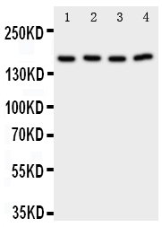 PLA2G4A Antibody - Anti-PLA2G4A antibody, Western blotting Lane 1: Rat Testis Tissue LysateLane 2: Rat Brain Tissue LysateLane 3: A549 Cell LysateLane 4: COLO320 Cell Lysate