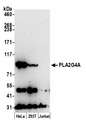 PLA2G4A Antibody - Detection of human PLA2G4A by western blot. Samples: Whole cell lysate (50 µg) from HeLa, HEK293T, and Jurkat cells prepared using NETN lysis buffer. Antibody: Affinity purified rabbit anti-PLA2G4A antibody used for WB at 0.1 µg/ml. Detection: Chemiluminescence with an exposure time of 3 minutes.