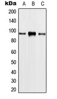 PLA2G4A Antibody - Western blot analysis of PLA2G4A expression in HeLa (A); THP1 (B); NIH3T3 (C) whole cell lysates.