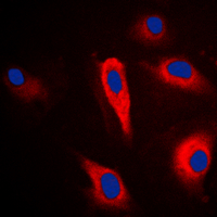 PLA2G4A Antibody - Immunofluorescent analysis of PLA2G4A staining in HeLa cells. Formalin-fixed cells were permeabilized with 0.1% Triton X-100 in TBS for 5-10 minutes and blocked with 3% BSA-PBS for 30 minutes at room temperature. Cells were probed with the primary antibody in 3% BSA-PBS and incubated overnight at 4 C in a humidified chamber. Cells were washed with PBST and incubated with a DyLight 594-conjugated secondary antibody (red) in PBS at room temperature in the dark. DAPI was used to stain the cell nuclei (blue).