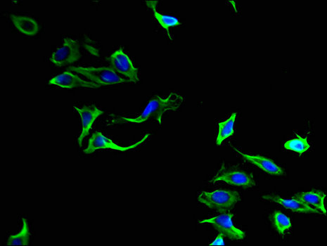 PLA2G4A Antibody - Immunofluorescent analysis of Hela cells using PLA2G4A Antibody at a dilution of 1:100 and Alexa Fluor 488-congugated AffiniPure Goat Anti-Rabbit IgG(H+L)