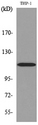PLA2G4A Antibody - Western blot analysis of lysate from THP-1 cells, using PLA2G4A Antibody.