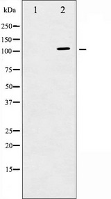 PLA2G4A Antibody - Western blot analysis of c-PLA2 expression in TNF-a treated HeLa whole cells lysates. The lane on the left is treated with the antigen-specific peptide.