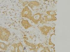 PLA2G4A Antibody - 1:100 staining human lung tissue by IHC-P. The sample was formaldehyde fixed and a heat mediated antigen retrieval step in citrate buffer was performed. The sample was then blocked and incubated with the antibody for 1.5 hours at 22°C. An HRP conjugated goat anti-rabbit antibody was used as the secondary.
