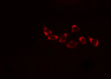 PLA2G4A Antibody - Staining A549 cells by IF/ICC. The samples were fixed with PFA and permeabilized in 0.1% Triton X-100, then blocked in 10% serum for 45 min at 25°C. The primary antibody was diluted at 1:200 and incubated with the sample for 1 hour at 37°C. An Alexa Fluor 594 conjugated goat anti-rabbit IgG (H+L) antibody, diluted at 1/600, was used as secondary antibody.