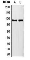 PLA2G4A Antibody - Western blot analysis of PLA2G4A (pS505) expression in HeLa lambda protein phosphatase-treated (A); NIH3T3 lambda protein phosphatase-treated (B) whole cell lysates.