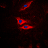 PLA2G4A Antibody - Immunofluorescent analysis of PLA2G4A (pS505) staining in HeLa cells. Formalin-fixed cells were permeabilized with 0.1% Triton X-100 in TBS for 5-10 minutes and blocked with 3% BSA-PBS for 30 minutes at room temperature. Cells were probed with the primary antibody in 3% BSA-PBS and incubated overnight at 4 C in a humidified chamber. Cells were washed with PBST and incubated with a DyLight 594-conjugated secondary antibody (red) in PBS at room temperature in the dark. DAPI was used to stain the cell nuclei (blue).