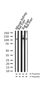 PLA2G4A Antibody - Western blot analysis of Phospho-c-PLA2 (Ser505) expression in various lysates