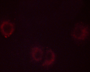 PLA2G4A Antibody - Staining C2C12 cells by IF/ICC. The samples were fixed with PFA and permeabilized in 0.1% saponin prior to blocking in 10% serum for 45 min at 37°C. The primary antibody was diluted 1/400 and incubated with the sample for 1 hour at 37°C. A Alexa Fluor 594 conjugated goat polyclonal to rabbit IgG (H+L), diluted 1/600 was used as secondary antibody.