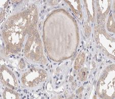 PLA2G4A Antibody - 1:200 staining human kidney tissue by IHC-P. The tissue was formaldehyde fixed and a heat mediated antigen retrieval step in citrate buffer was performed. The tissue was then blocked and incubated with the antibody for 1.5 hours at 22°C. An HRP conjugated goat anti-rabbit antibody was used as the secondary.