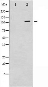 PLA2G4A Antibody - Western blot analysis of c-PLA2 phosphorylation expression in TNF-a treated HeLa whole cells lysates. The lane on the left is treated with the antigen-specific peptide.