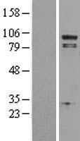 PLA2G4A Protein - Western validation with an anti-DDK antibody * L: Control HEK293 lysate R: Over-expression lysate